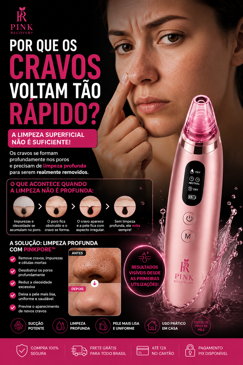 PinkPore Pro™ | Removedor de Cravos a Vácuo