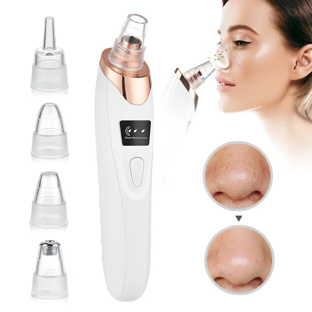 Electric Blackhead Remover USB Face Deep Cleansing Pore Beauty Machine Dead Skin Remover Face Vacuum Blackhead Removal Skin Care