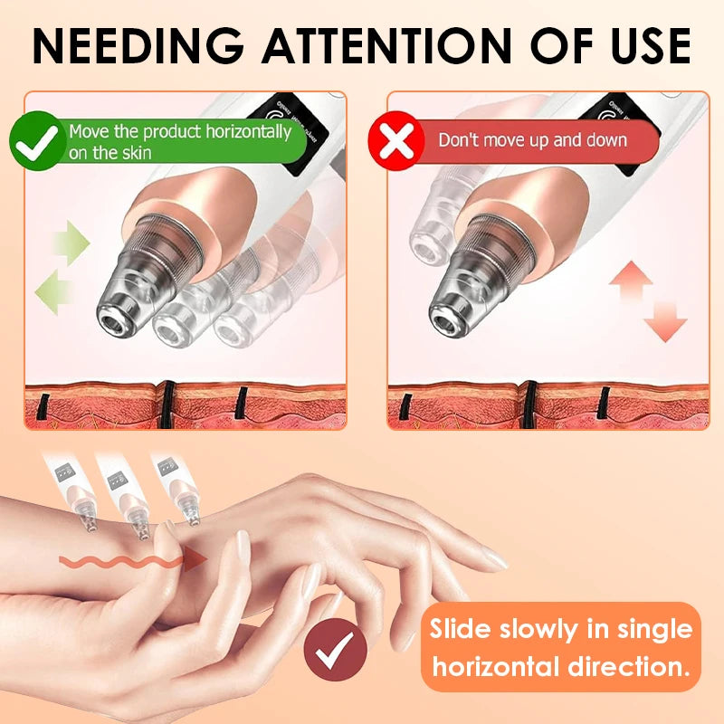 Electric Blackhead Remover USB Face Deep Cleansing Pore Beauty Machine Dead Skin Remover Face Vacuum Blackhead Removal Skin Care