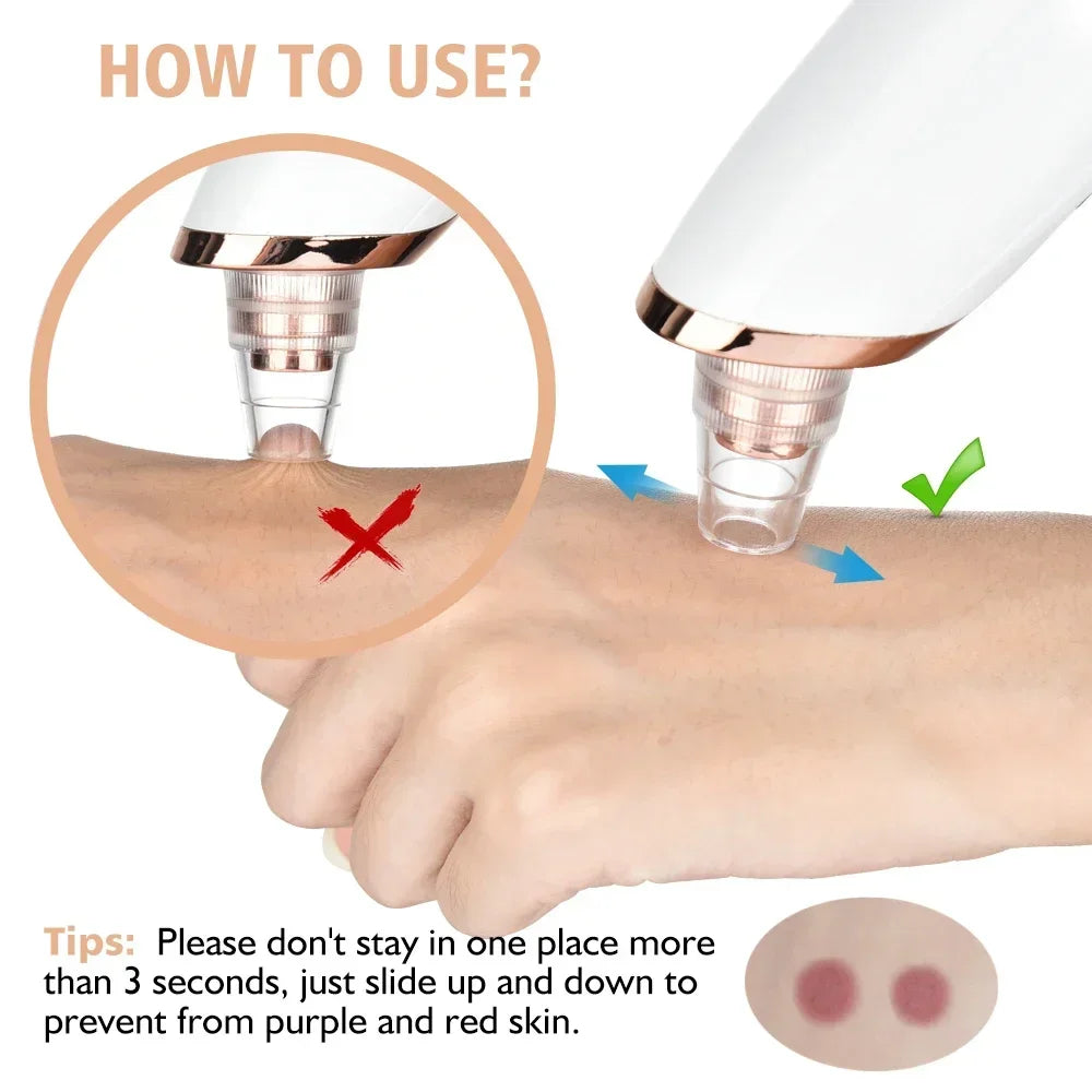 Electric Blackhead Remover USB Face Deep Cleansing Pore Beauty Machine Dead Skin Remover Face Vacuum Blackhead Removal Skin Care
