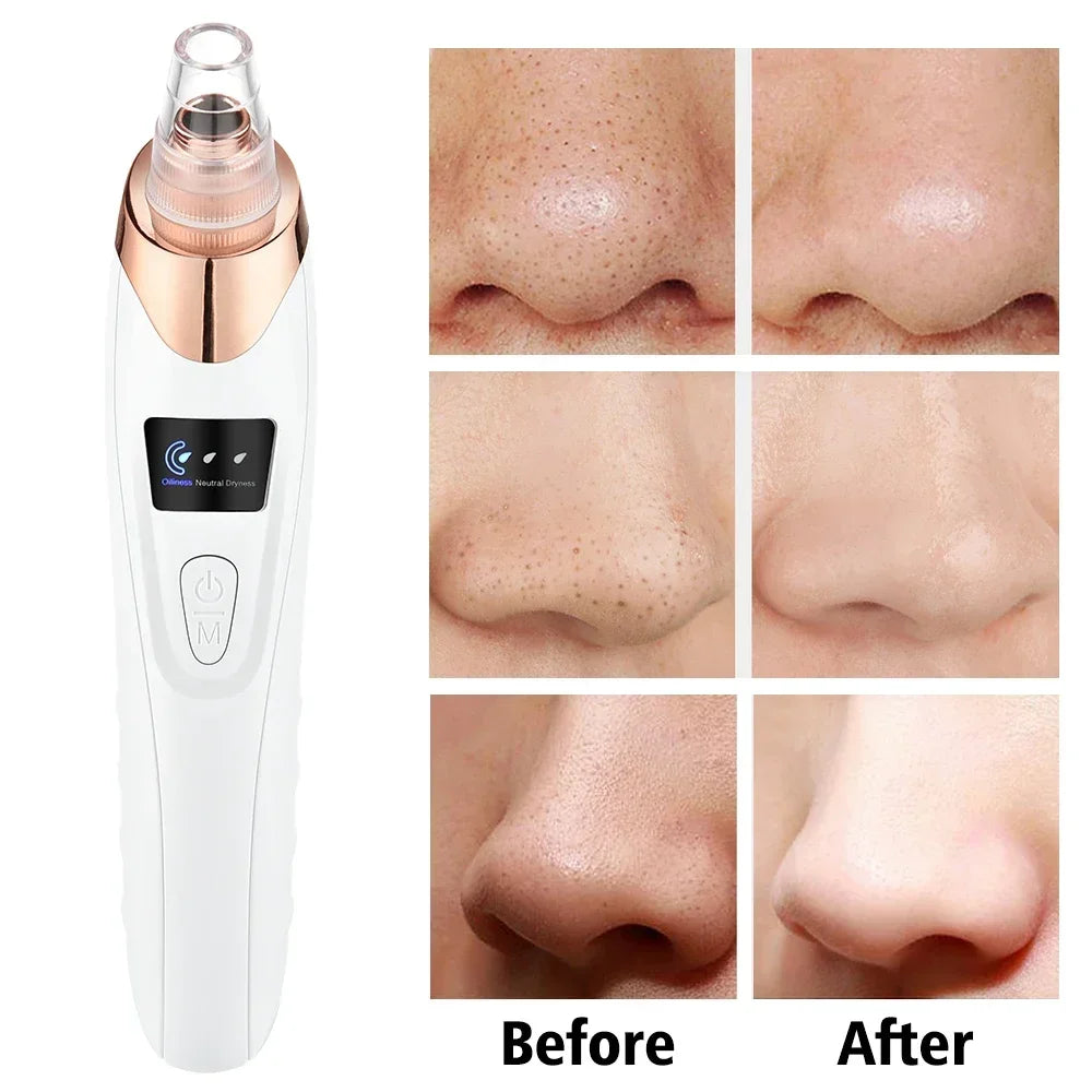 Electric Blackhead Remover USB Face Deep Cleansing Pore Beauty Machine Dead Skin Remover Face Vacuum Blackhead Removal Skin Care