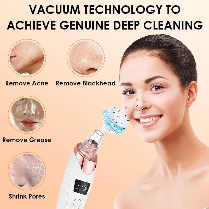 Electric Blackhead Remover USB Face Deep Cleansing Pore Beauty Machine Dead Skin Remover Face Vacuum Blackhead Removal Skin Care